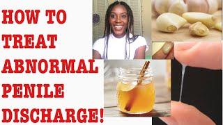 Home Remedies for ABNORMAL Penile Discharge: D&N Medical Series