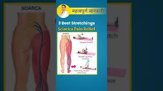 Sciatica Pain Relief  #shorts #physiodrdeepaksoni #sciatica