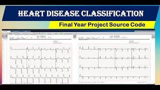 Heart Disease Classification Using Machine Learning  | Heart Disease Detection Using Matlab