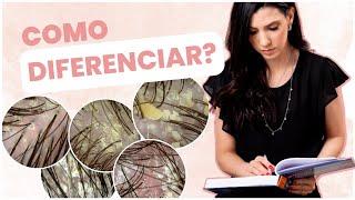 Diferenças entre DERMATITE SEBORREICA e PSORÍASE