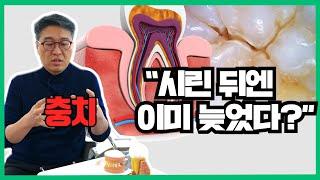 치과마다 충치 개수 다르게 알려주는 이유 / 신경치료 받기 싫으면 미리미리 가자 - [올쏘의 아싸  시즌1_Ep6]