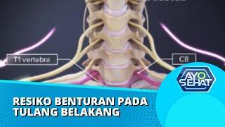 Apa Resikon Penderita yang Mengalami Benturan Pada Tulang Belakang? | AYO SEHAT