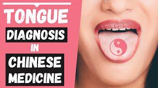 Tongue Diagnosis in TCM (made easy)