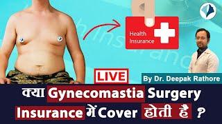 Gynecomastia Surgery and Insurance | Kya Gynecomastia Surgery Insurance Me cover Hoti Hai?