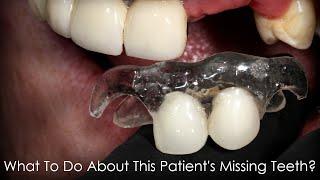 What to do About This Patient's Missing Teeth