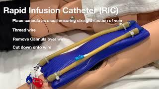 RIC line insertion