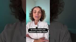 Как отличить обычный отек от начала лимфедемы