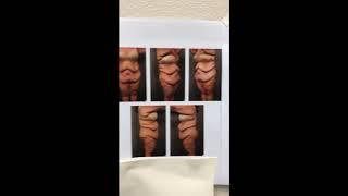 Body Contouring Plastic Surgery