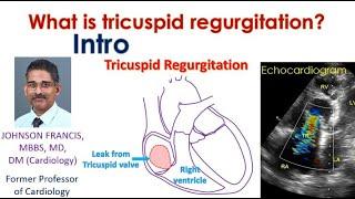 What is tricuspid regurgitation? - Intro