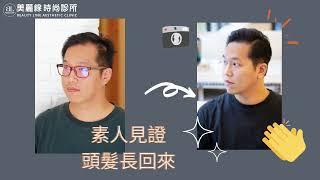 療程分享 | FUE植髮 | 美麗線時尚診所