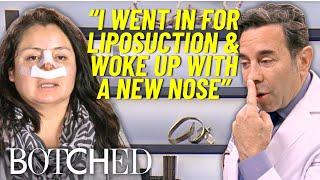 Mariela Was Given A Nose Job WITHOUT Her Consent | Botched | E!