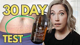  SHOCKING RESULTS?! Castor Oil on Stretch Marks? My 30 Day Test!!