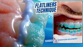 FLATLINERS Technique  en Blanqueamiento Dental