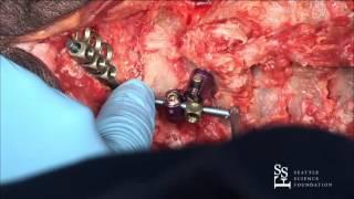 Bioskills Lab - Tips and Tricks for Integrating Surgical Imaging into Surgery - Rick C Sasso, MD