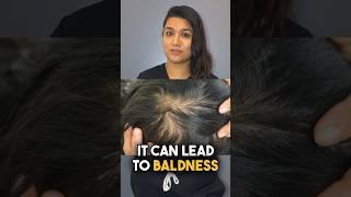 Female Hair Loss: Triggering Factors Explained by Dr. Aleena