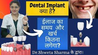 Dental Implant Procedure in Hindi| Cost In India| Time For Treatment| Dr.Shweta Sharma