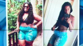 Atlanta woman shares how she lost 150 pounds | FOX Medical Team