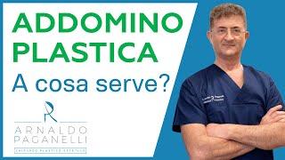 Addominoplastica a cosa serve ? - Dr Arnaldo Paganelli Chirurgo Plastico