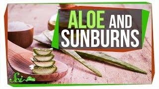 Does Aloe Really Treat a Sunburn?