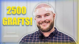 FULL FUE Hair Transplant Experience LONDON | Joe | Westminster Medical Group