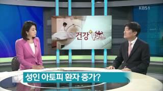 [건강 플러스] ‘아토피 피부염’ 원인과 치료 방법은?