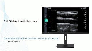 ASUS Handheld Ultrasound LU800 | Introduction to IMT measurement