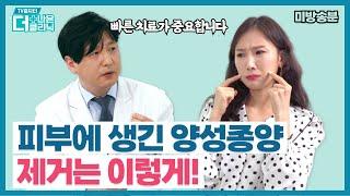 [티비홈닥터] 미방송분_피부에 생긴 혹! 어떻게 제거할까?