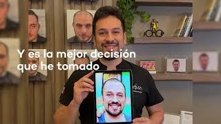 RECUPERA TU CABELLO CON INJERTO CAPILAR/ CAPILEA MEXICO