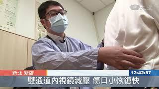 椎間盤突出 雙通道內視鏡減壓術