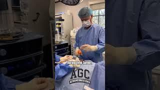 Gynecomastia Surgery Before and After #drcaridi  #menshealth #chestworkout #bodytransformation