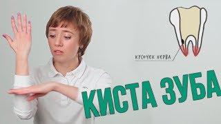 Как она образуется КИСТА ЗУБА? (Школа здоровых зубов)