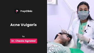 Acne Vulgaris | Dr. Chesta Agrawal | Dermatology PrepClinic