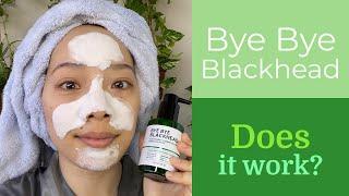 SomebyMi Bye Bye Blackhead Cleanser | Remove Blackheads | Does it work??