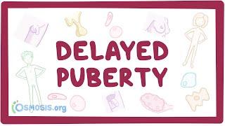 Delayed puberty - causes, symptoms, diagnosis, treatment, pathology