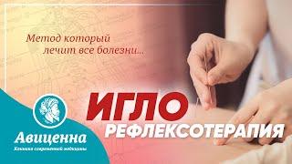 Метод, который лечит все болезни | Иглорефлексотерапия