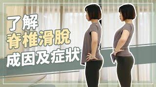 久坐族高危險群注意!了解脊椎滑脫成因及症狀｜詹珞瑤 物理治療師 Veronica Rehab