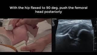 Paediatric Hip Ultrasound: supine alternative