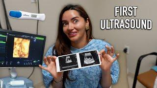 OUR VERY FIRST PREGNANCY ULTRASOUND!! + EMOTIONAL FIRST MOTHER'S/FATHER'S DAY!!