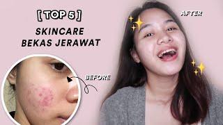 SKINCARE UNTUK BEKAS JERAWAT MERAH, COKLAT, HITAM | Niacinamide, Vit C, AHA!