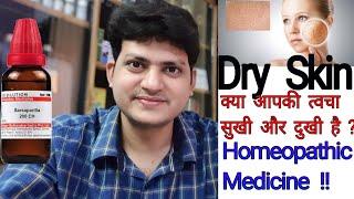 सुखी रूखी बेजान त्वचा के लिए होम्योपैथिक दवा । Homeopathic Medicine for dry skin ?