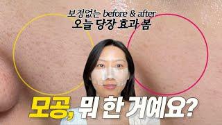 7년차 홈케어 전문가가 알려주는 모공 줄이는 법‍️  10분만에 깐달걀되는 꿀팁 대방출