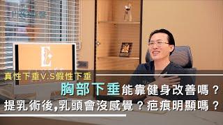 『胸部下垂能用健身改善嗎？提乳手術後乳頭會沒感覺？提乳疤痕能隱藏嗎？胸部下垂也有分真假？』#Pro好醫