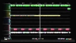 Ezmuze Harmonic Distortion