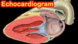 Echocardiogram