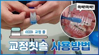 교정 중 양치방법 - 교정칫솔 사용방법