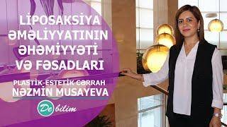 DİQQƏTLİ OLUN! Piy sovurma əməliyyatının əhəmiyyəti və fəsadları.