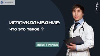 Иглоукалывание: что это такое?