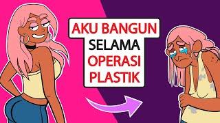 AKU MELAKUKAN KESALAHAN FATAL TERBANGUN SELAMA OPERASI PLASTIK...  | KISAH DIRIKU