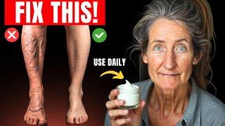 "SAY GOODBYE TO PAINFUL LEGS!" Varicose Veins Treatment That ACTUALLY Works! | Barbara O'Neill