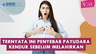 4 Penyebab Utama Payudara Kendur Sebelum Menikah dan Menyusui